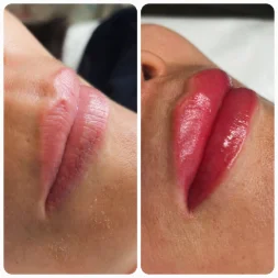 Salon Essential client's before and after photo after receiving lip blush services